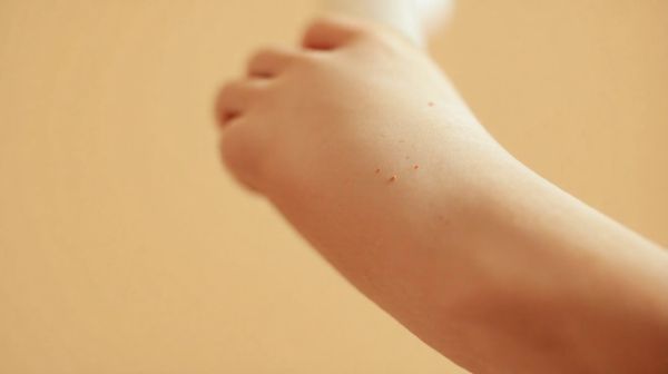 10 astuces incontournables pour prévenir les poils incarnés
